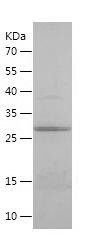    IFT140 / Recombinant Human IFT140