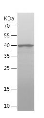    CEP164 / Recombinant Human CEP164
