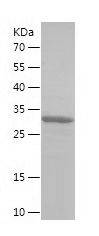    GUCA2B / Recombinant Human GUCA2B