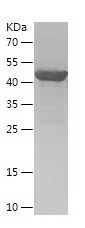    ATP5F1B / Recombinant Human ATP5F1B