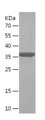    CRABP2 / Recombinant Human CRABP2