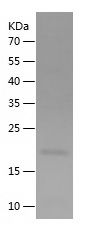    PRAP1 / Recombinant Human PRAP1