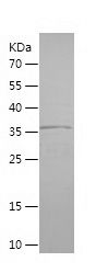    ABHD5 / Recombinant Human ABHD5