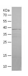    UQCRC2 / Recombinant Human UQCRC2