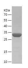    S100A14 / Recombinant Human S100A14