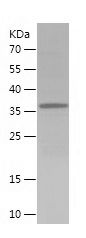    GLI2 / Recombinant Human GLI2