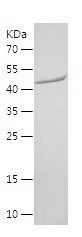    KDM3A / Recombinant Human KDM3A