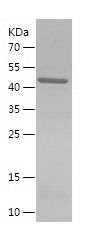    BHMT / Recombinant Human BHMT