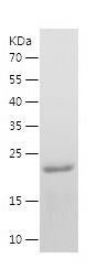    RORB / Recombinant Human RORB