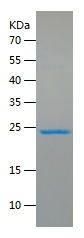    PRDX1 / Recombinant Human PRDX1