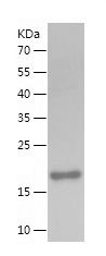    SOD1 / Recombinant Human SOD1