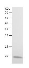    TMSB4X / Recombinant Human TMSB4X