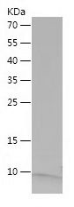    SPINK1 / Recombinant Human SPINK1