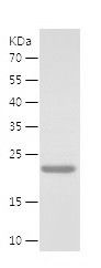    NCALD / Recombinant Human NCALD