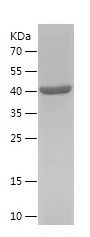    IFT81 / Recombinant Human IFT81