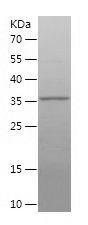    PYCR1 / Recombinant Human PYCR1