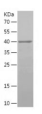    SNX27 / Recombinant Human SNX27