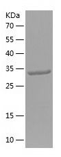    SLC11A2 / Recombinant Human SLC11A2