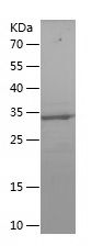    NOTCH3 / Recombinant Human NOTCH3