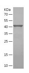    ODF2 / Recombinant Human ODF2