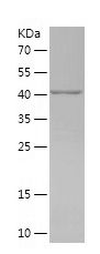    GBP5 / Recombinant Human GBP5