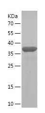    WASL / Recombinant Human WASL