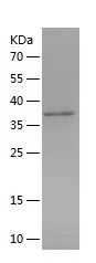    FLT4 / Recombinant Human FLT4