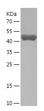    PDIA1 / Recombinant Human PDIA1