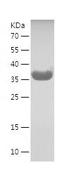    LASP1 / Recombinant Human LASP1