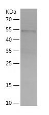    FBLN5 / Recombinant Human FBLN5