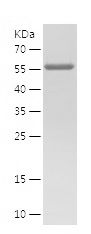    SETDB1 / Recombinant Human SETDB1