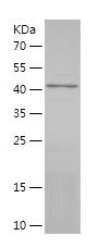    ADAM12 / Recombinant Human ADAM12