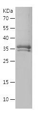    AGTR1 / Recombinant Human AGTR1