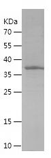    SRD5A1 / Recombinant Human SRD5A1