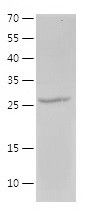    CD20 / Recombinant Human CD20