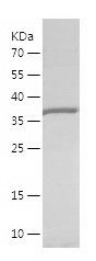    AKR1C2 / Recombinant Human AKR1C2