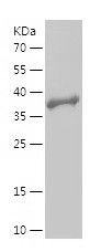    PLEKHO2 / Recombinant Human PLEKHO2