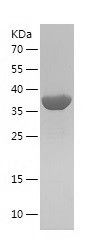    akr1b10 / Recombinant Human akr1b10