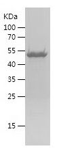    TRIM21 / Recombinant Human TRIM21