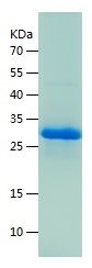    TRIM63 / Recombinant Human TRIM63