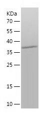    TRIM17 / Recombinant Human TRIM17