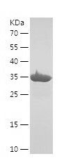    SRXN1 / Recombinant Human SRXN1