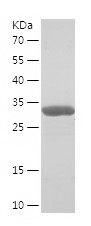    S100A4 / Recombinant Human S100A4