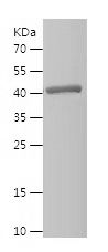    MTHFD2 / Recombinant Human MTHFD2