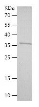    YTHDC1 / Recombinant Human YTHDC1