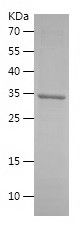    YWHAZ / Recombinant Human YWHAZ