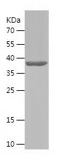    TBC1D17 / Recombinant Human TBC1D17