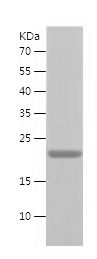    COMMD1 / Recombinant Human COMMD1