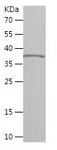    GAD1 / Recombinant Human GAD1