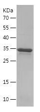    SFTPD / Recombinant Human SFTPD